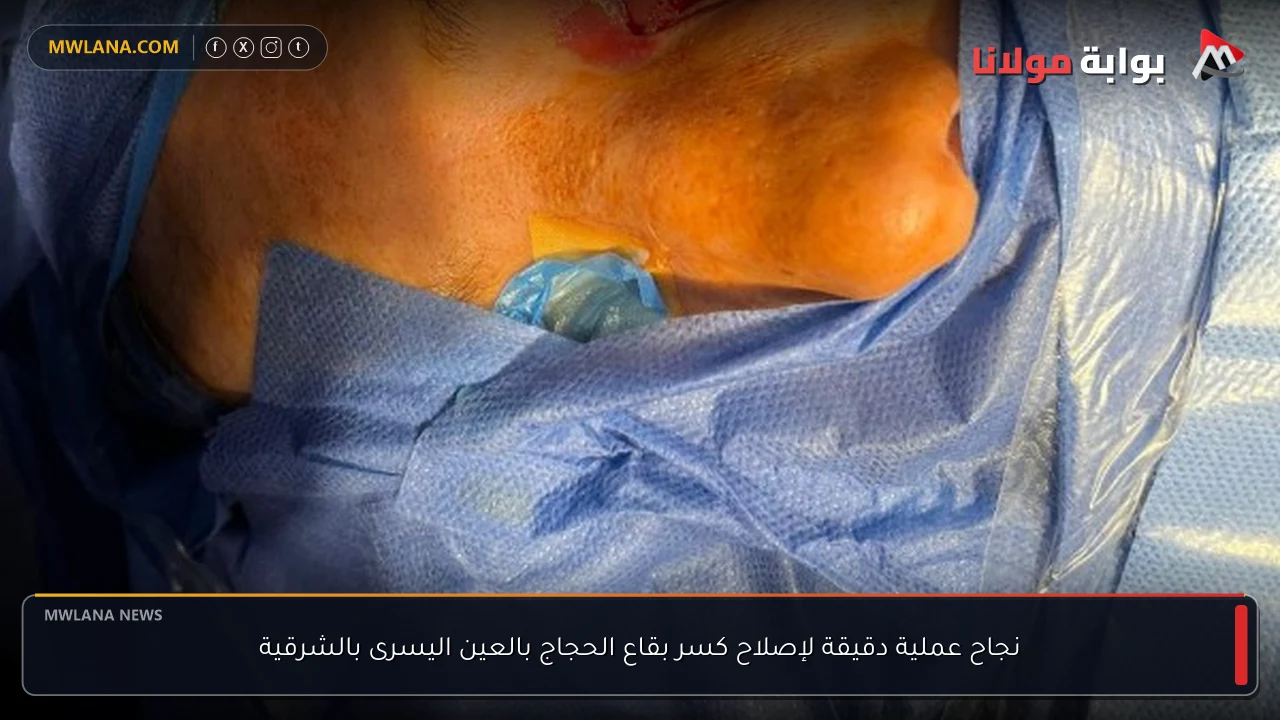 نجاح عملية دقيقة لإصلاح كسر بقاع الحجاج بالعين اليسرى بالشرقية
