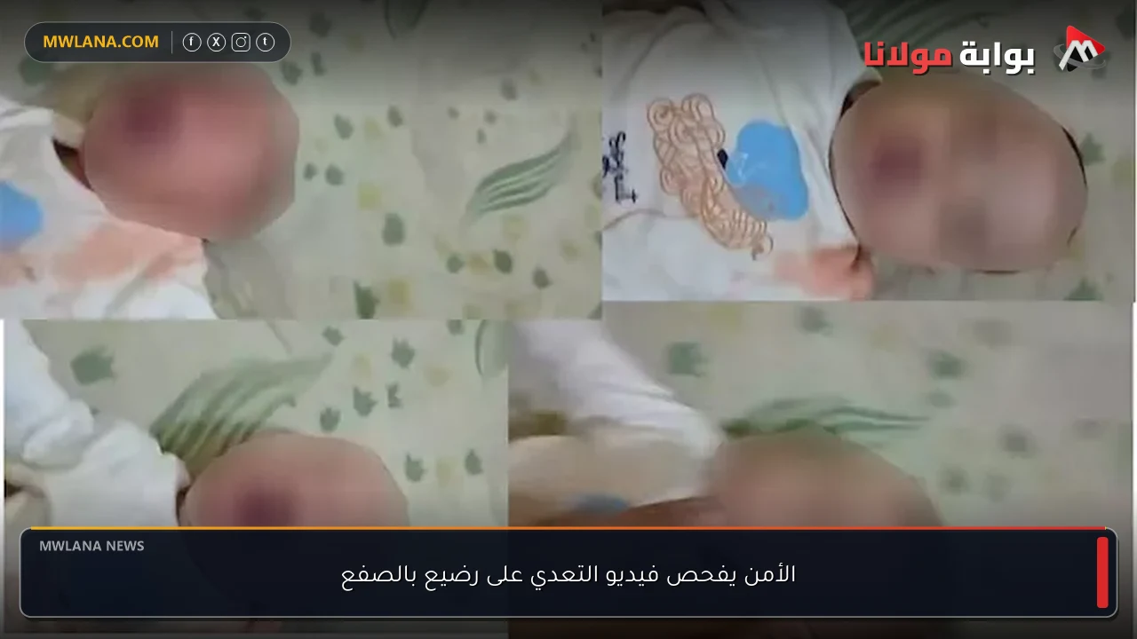 الأمن يفحص فيديو التعدي على رضيع بالصفع