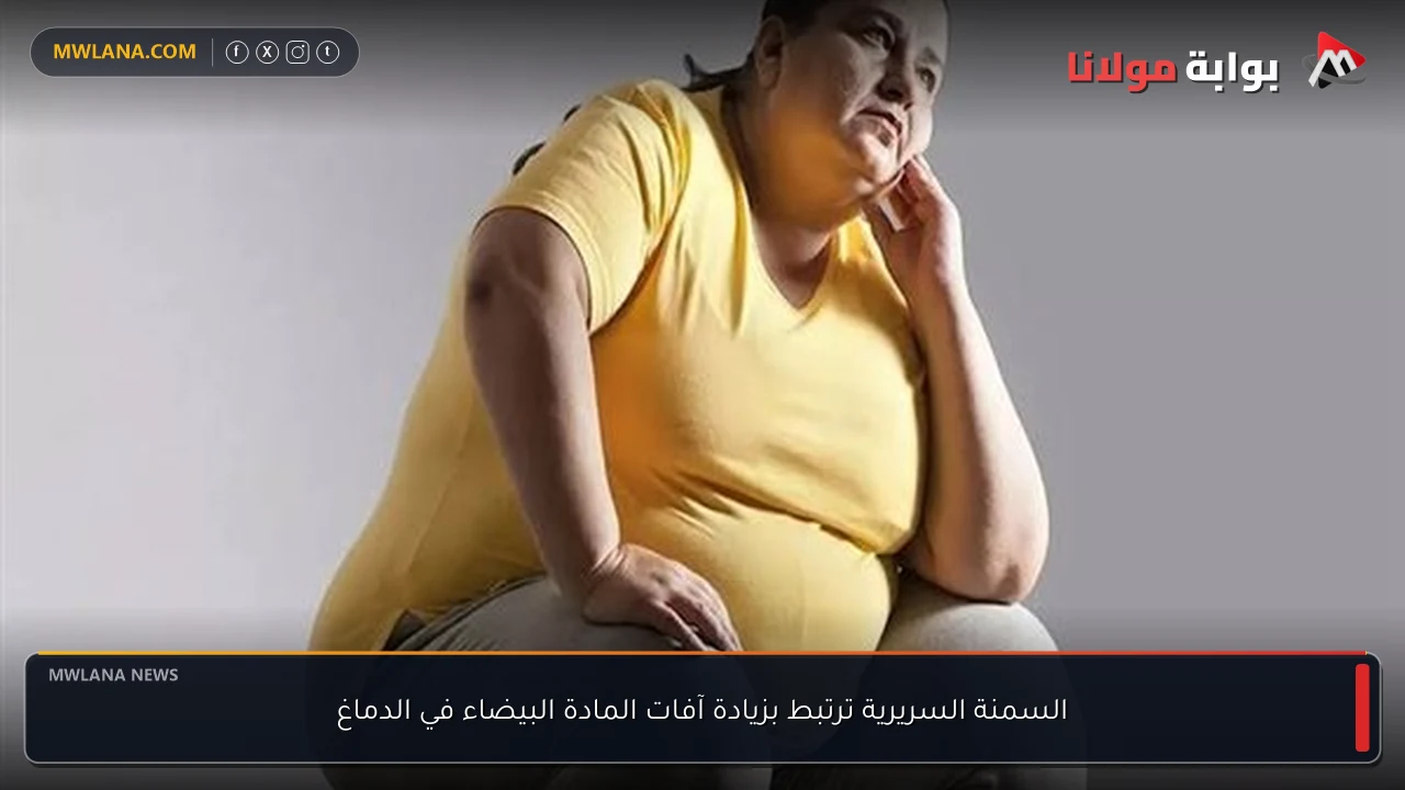 السمنة السريرية ترتبط بزيادة آفات المادة البيضاء في الدماغ