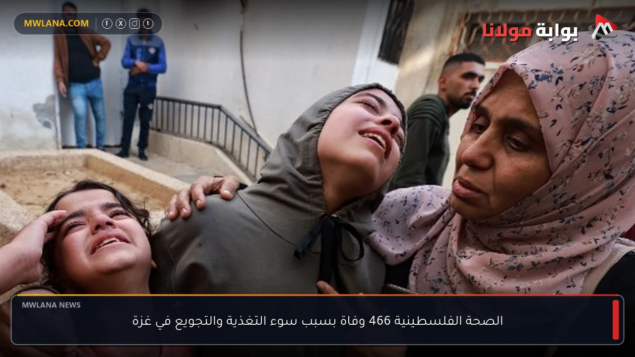الصحة الفلسطينية 466 وفاة بسبب سوء التغذية والتجويع في غزة