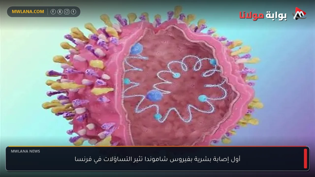 أول إصابة بشرية بفيروس شاموندا تثير التساؤلات في فرنسا