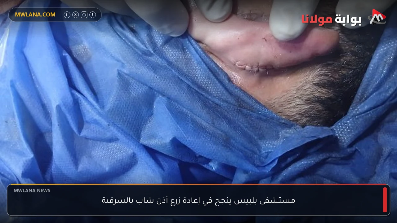 مستشفى بلبيس ينجح في إعادة زرع أذن شاب بالشرقية