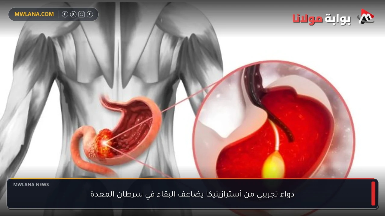 دواء تجريبي من أسترازينيكا يضاعف البقاء في سرطان المعدة