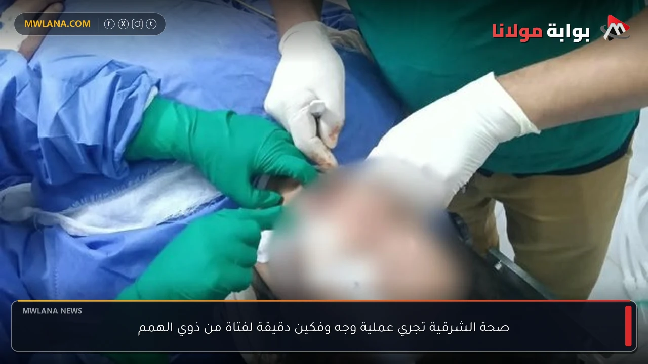 صحة الشرقية تجري عملية وجه وفكين دقيقة لفتاة من ذوي الهمم
