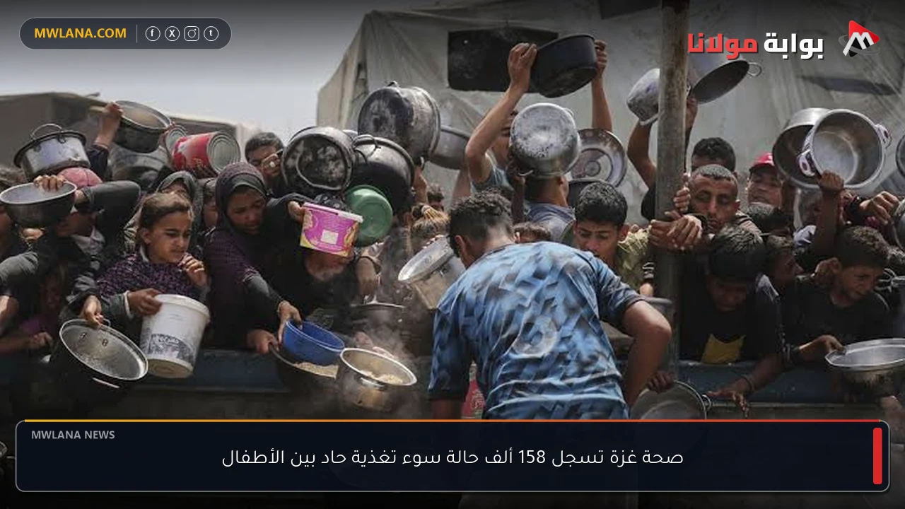 صحة غزة تسجل 158 ألف حالة سوء تغذية حاد بين الأطفال
