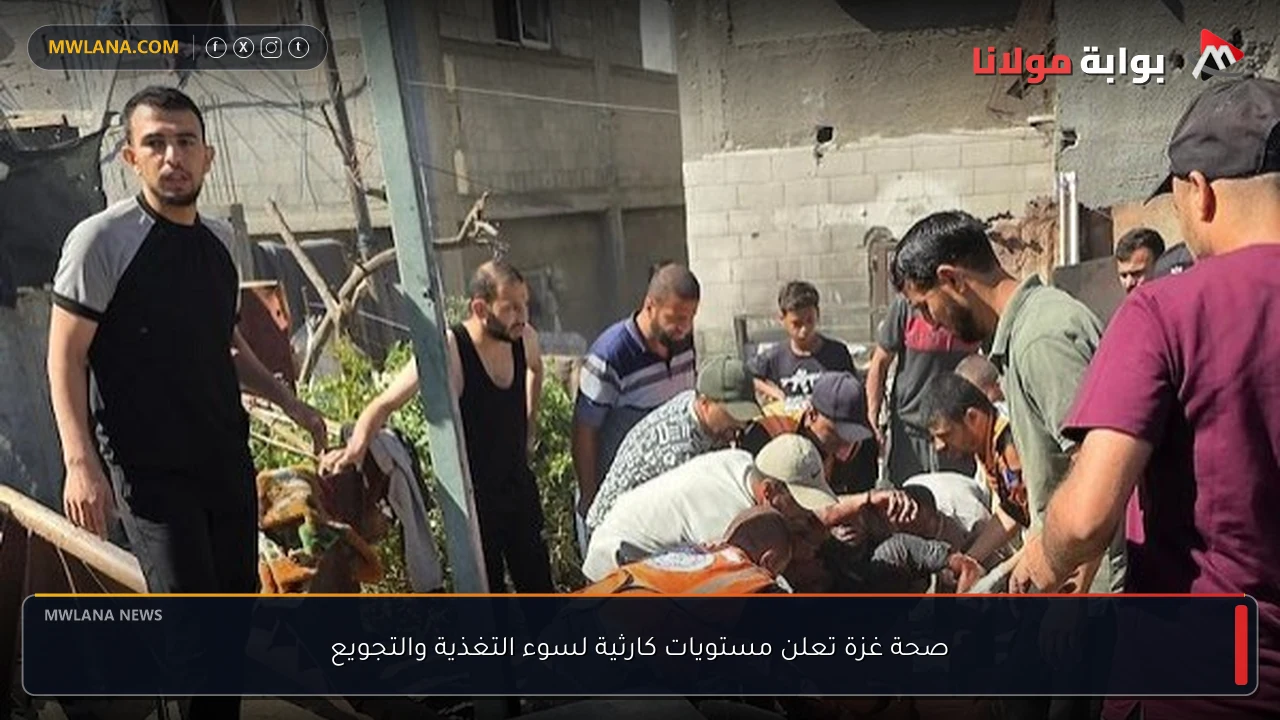 صحة غزة تعلن مستويات كارثية لسوء التغذية والتجويع