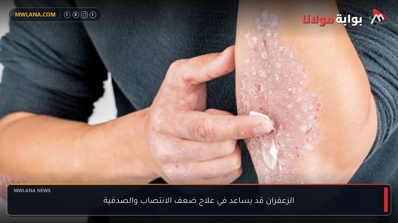 الزعفران قد يساعد في علاج ضعف الانتصاب والصدفية