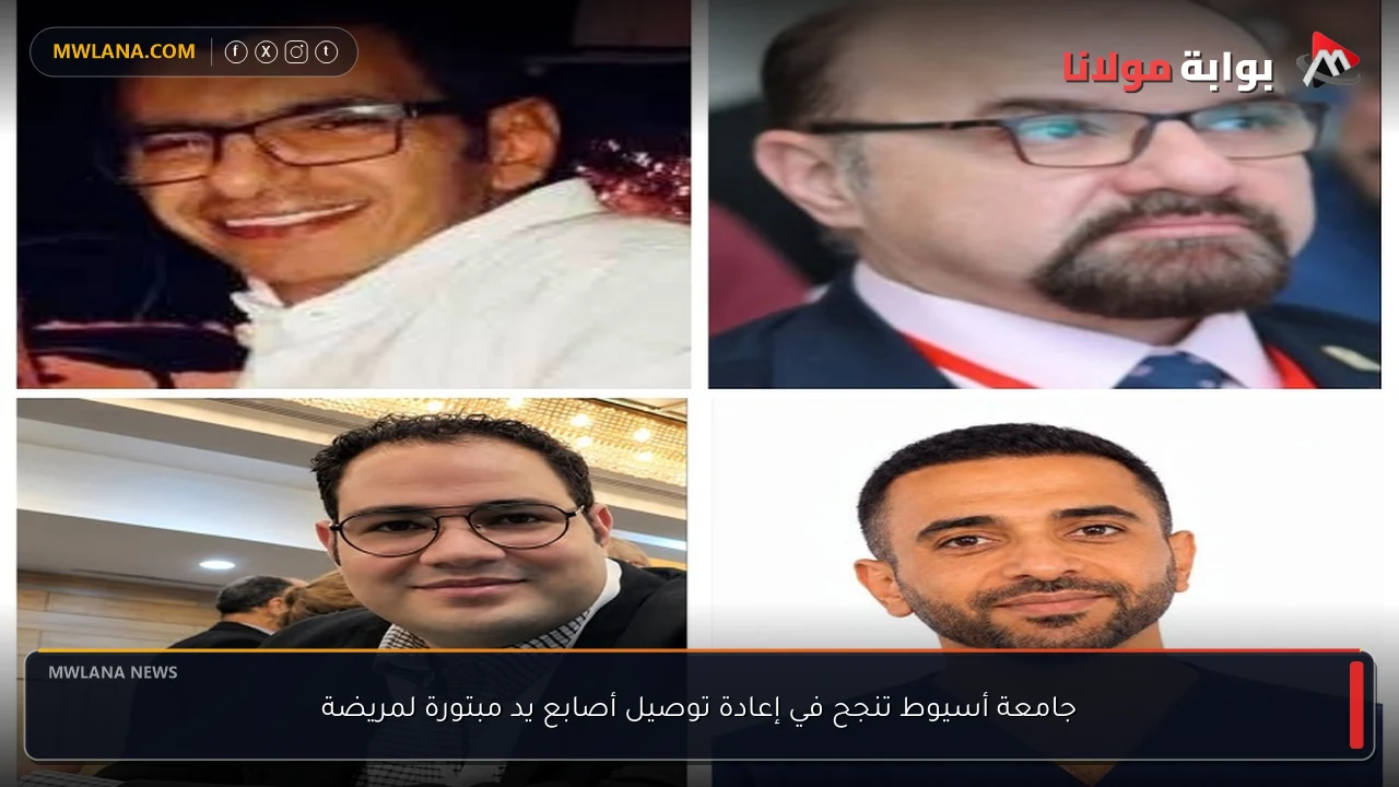 جامعة أسيوط تنجح في إعادة توصيل أصابع يد مبتورة لمريضة