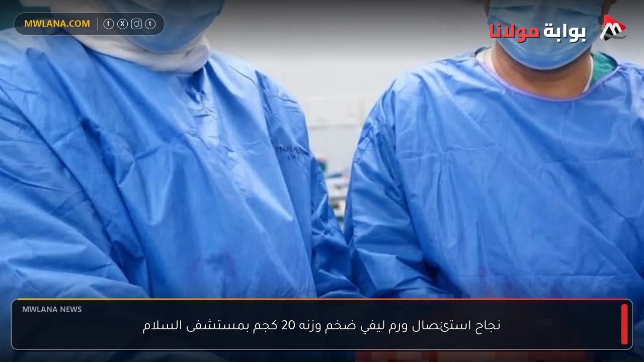 نجاح استئصال ورم ليفي ضخم وزنه 20 كجم بمستشفى السلام
