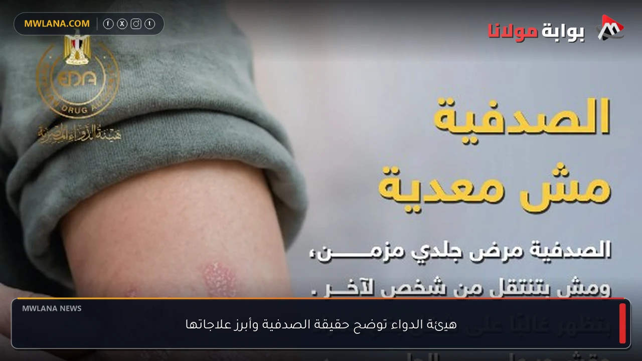 هيئة الدواء توضح حقيقة الصدفية وأبرز علاجاتها