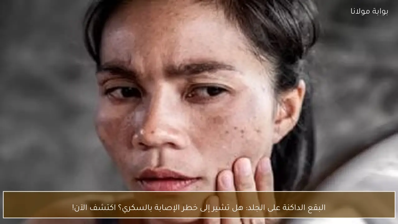البقع الداكنة على الجلد: هل تشير إلى خطر الإصابة بالسكري؟ اكتشف الآن!