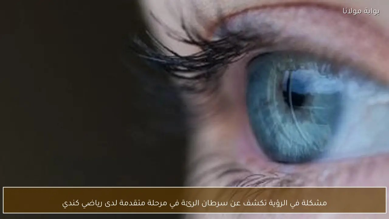 مشكلة في الرؤية تكشف عن سرطان الرئة في مرحلة متقدمة لدى رياضي كندي