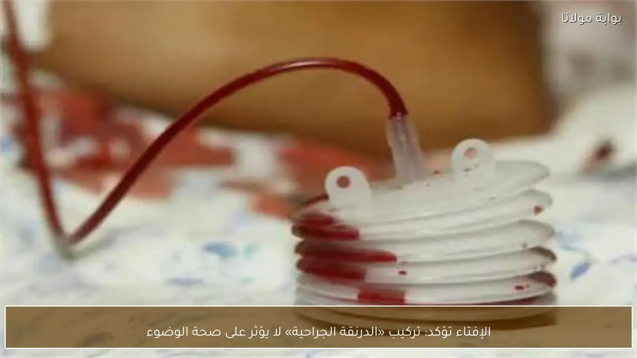 الإفتاء تؤكد: تركيب «الدرنقة الجراحية» لا يؤثر على صحة الوضوء