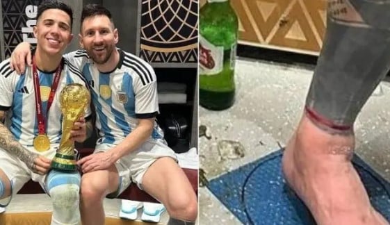 ميسى والسوار الاحمر ميسى والسوار الاحمر