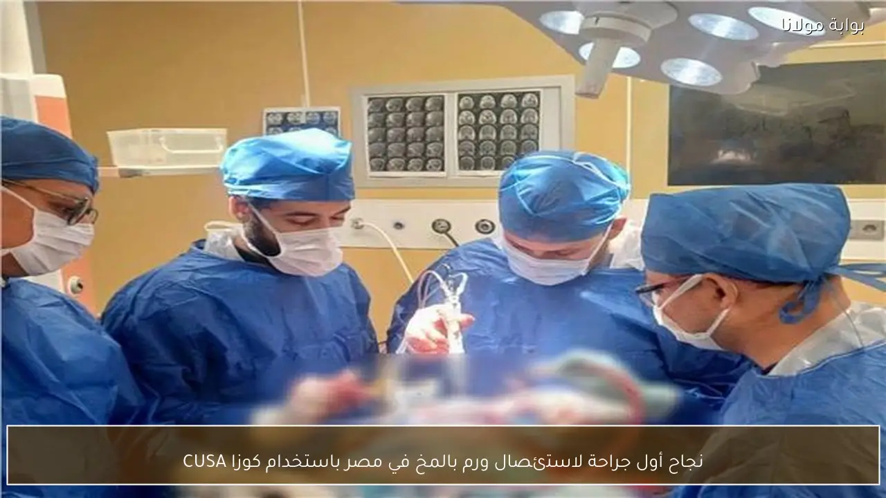 نجاح أول جراحة لاستئصال ورم بالمخ في مصر باستخدام كوزا CUSA