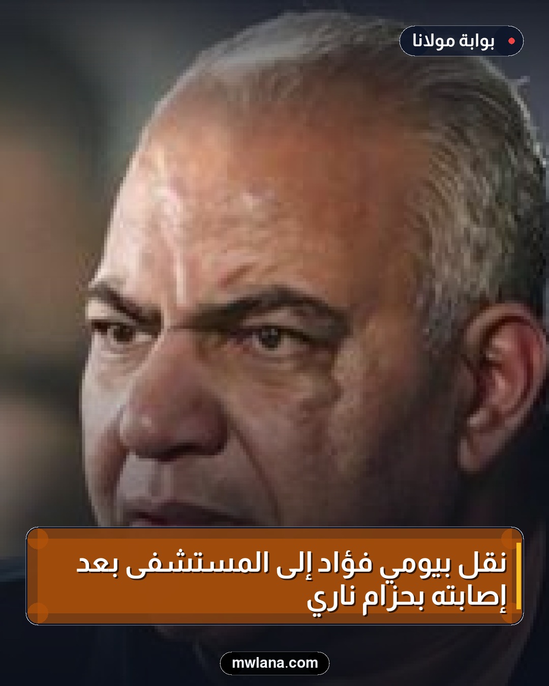 نقل بيومي فؤاد إلى المستشفى بعد إصابته بحزام ناري