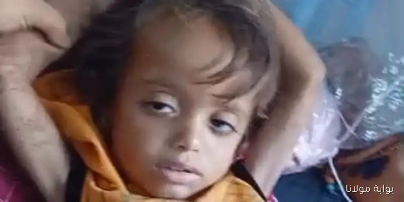 حياة الطفل خليل أبو شعيرة في خطر جراء العدوان على غزة وأمه تناشد لإنقاذه