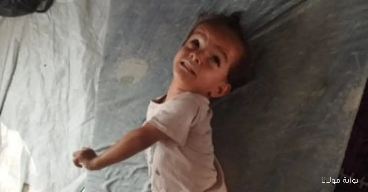 الطفلة الفلسطينية نايا أبو ريدة: العدوان دمر طفولتها وأدى إلى إصابتها بالشلل