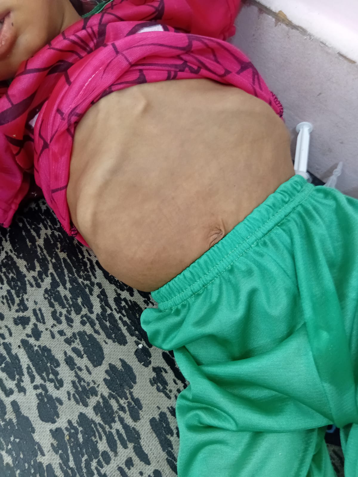 آثار المرض للطفل خليل أبو شعيرة