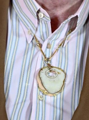 إلتون جون  يحول ركبته لعقد