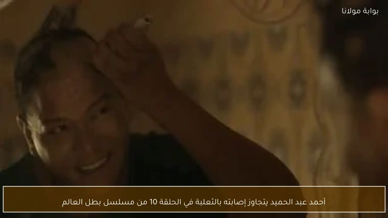 أحمد عبد الحميد يتجاوز إصابته بالثعلبة في الحلقة 10 من مسلسل بطل العالم