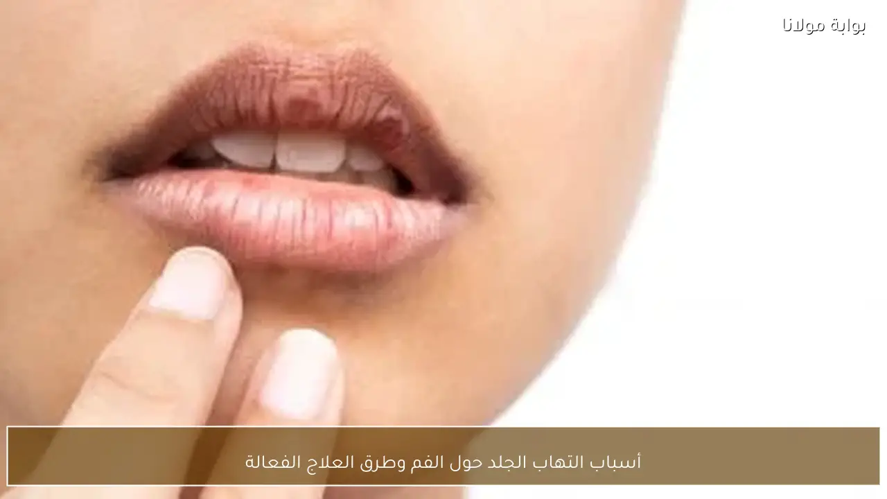 أسباب التهاب الجلد حول الفم وطرق العلاج الفعالة