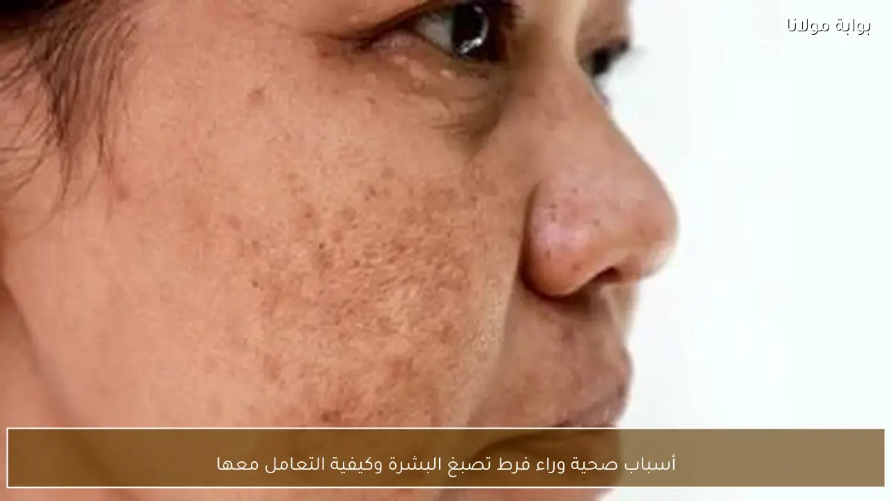 أسباب صحية وراء فرط تصبغ البشرة وكيفية التعامل معها