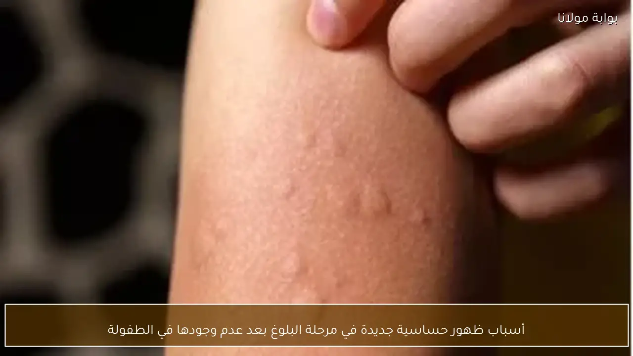 أسباب ظهور حساسية جديدة في مرحلة البلوغ بعد عدم وجودها في الطفولة