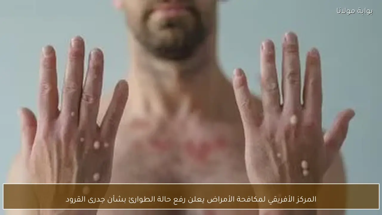 المركز الأفريقي لمكافحة الأمراض يعلن رفع حالة الطوارئ بشأن جدرى القرود