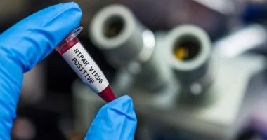  فيروس نيباه شديد الخطورة.. كيف ينتقل وما أخطر المضاعفات