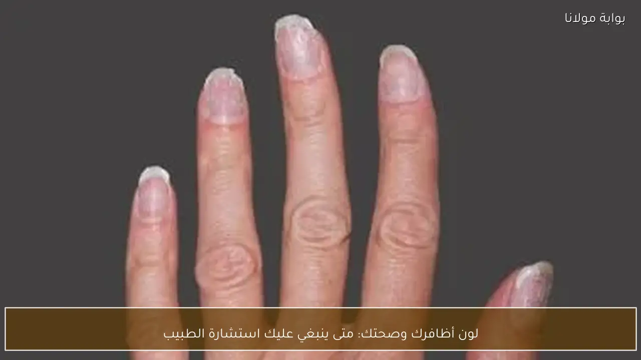 لون أظافرك وصحتك: متى ينبغي عليك استشارة الطبيب