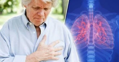 أعراض مبكرة لسرطان الرئة لا تتجاهلها أبداً