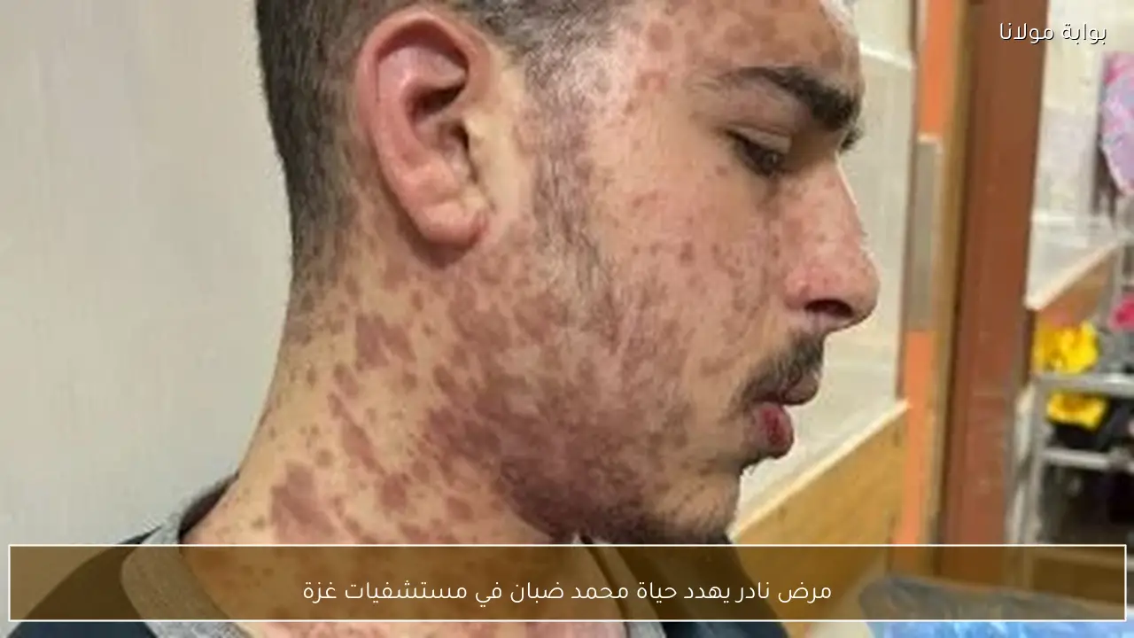 مرض نادر يهدد حياة محمد ضبان في مستشفيات غزة