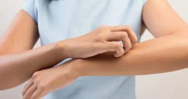 حساسية الطعام.. 5 علامات مبكرة لا يجب تجاهلها للوقاية من المضاعفات