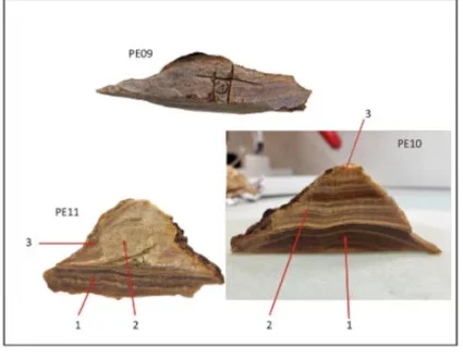 قطع من الجمجمة قطع من الجمجمة