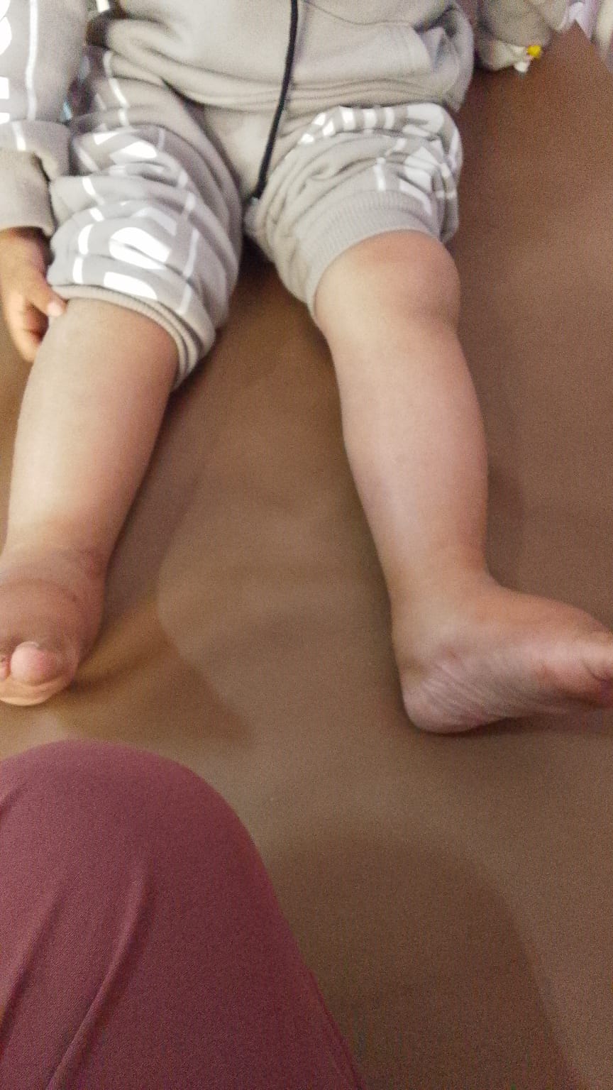 مرض الطفل ياسر عرفات