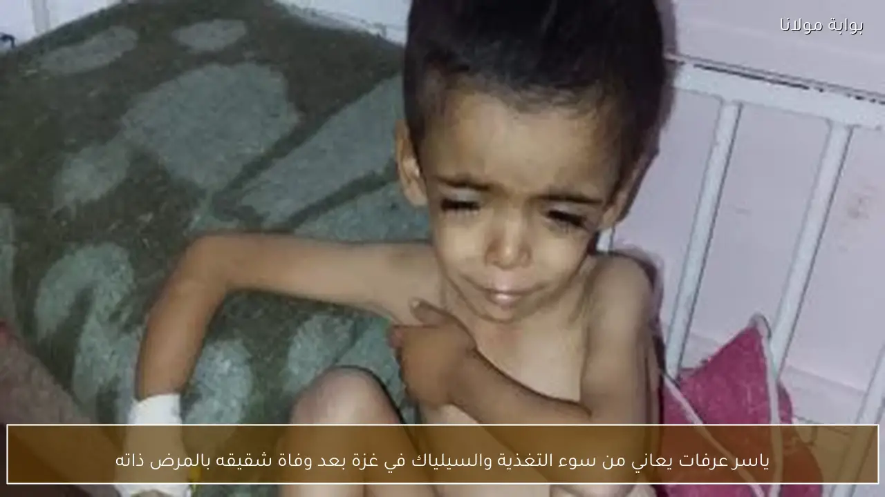 ياسر عرفات يعاني من سوء التغذية والسيلياك في غزة بعد وفاة شقيقه بالمرض ذاته