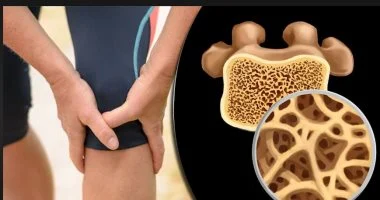 ألم العظام.. الأسباب الشائعة والخطيرة وطرق التشخيص والعلاج