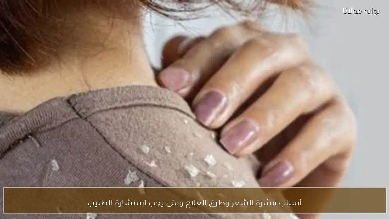 أسباب قشرة الشعر وطرق العلاج ومتى يجب استشارة الطبيب
