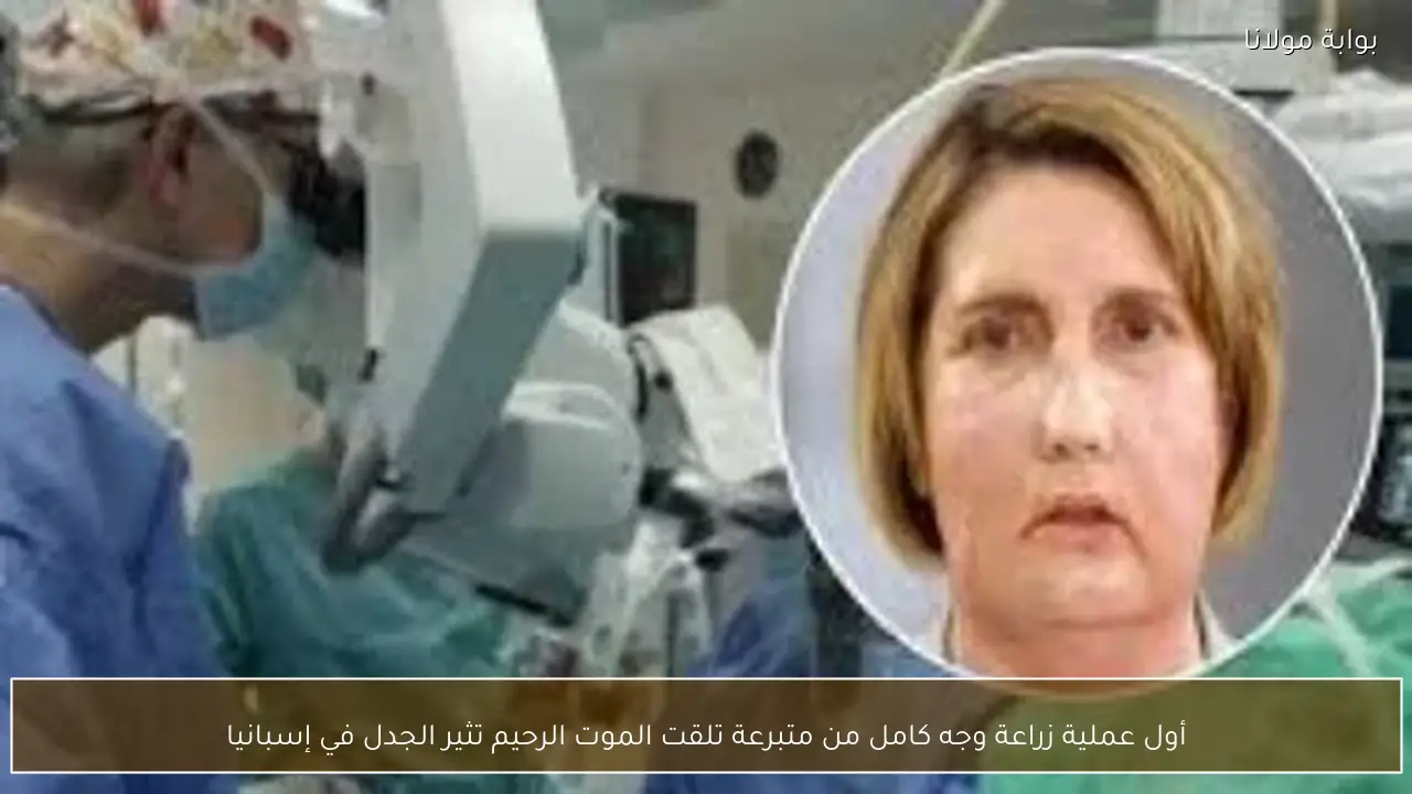 أول عملية زراعة وجه كامل من متبرعة تلقت الموت الرحيم تثير الجدل في إسبانيا