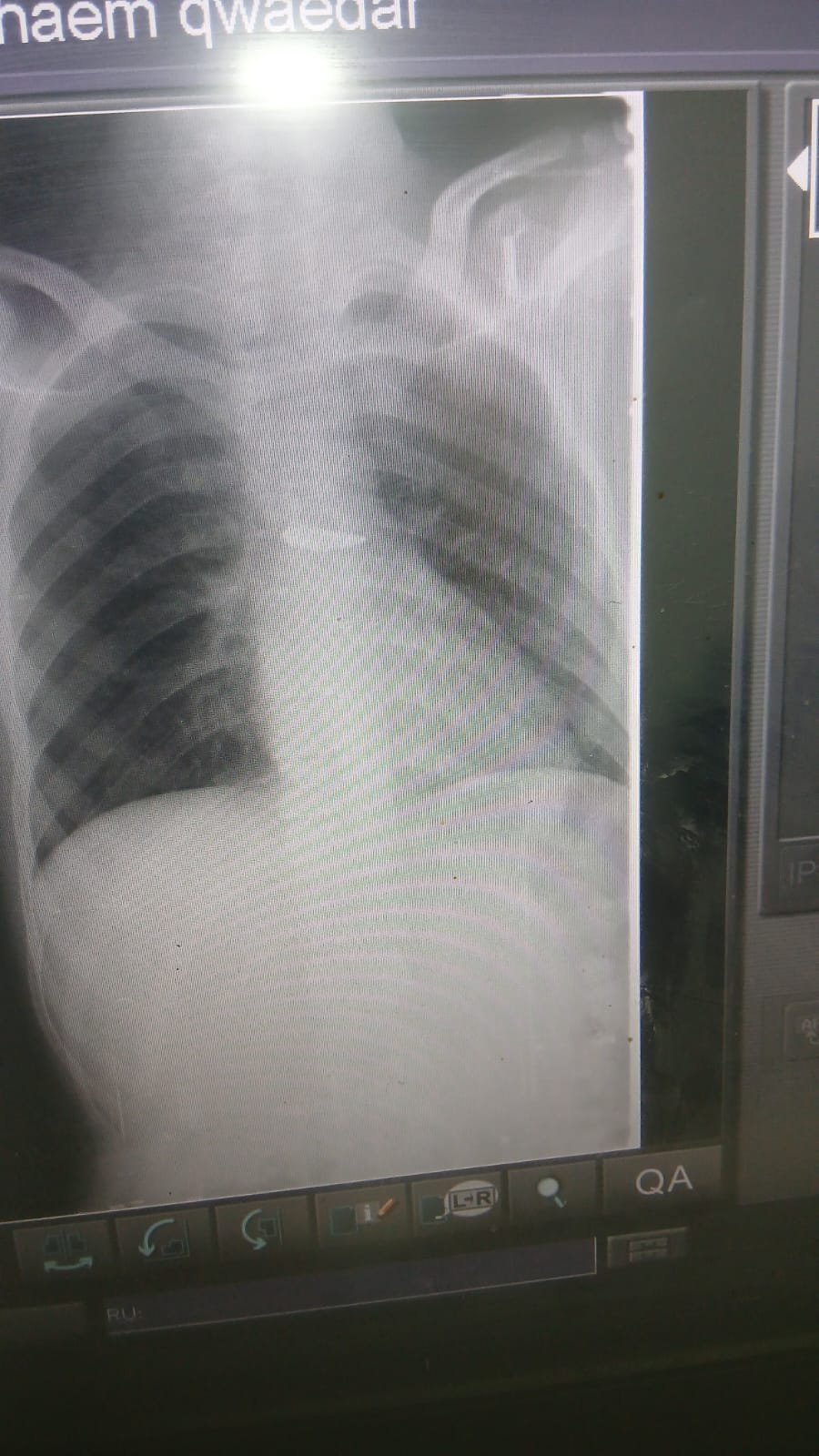 أشعة خاصة بإبراهيم قويدر