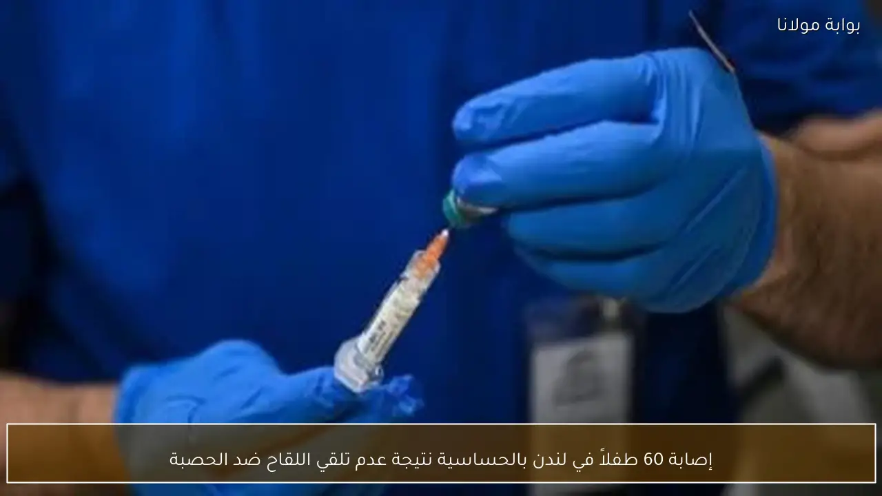 إصابة 60 طفلاً في لندن بالحساسية نتيجة عدم تلقي اللقاح ضد الحصبة