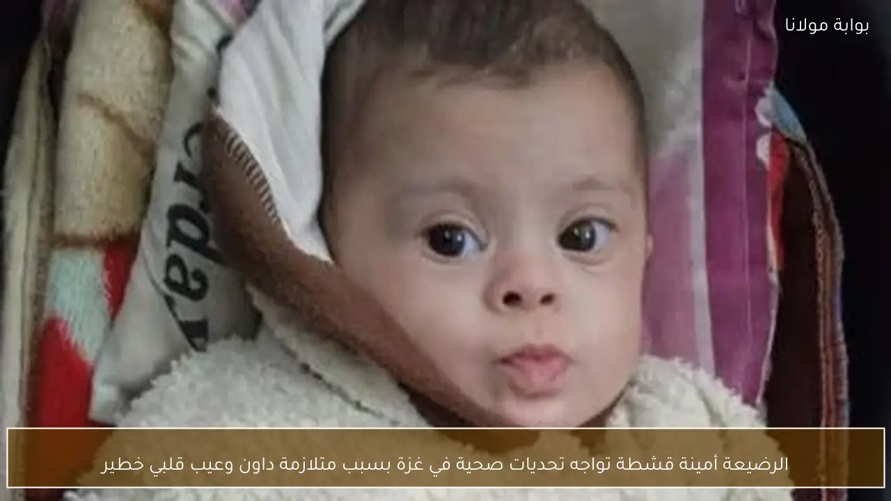 الرضيعة أمينة قشطة تواجه تحديات صحية في غزة بسبب متلازمة داون وعيب قلبي خطير