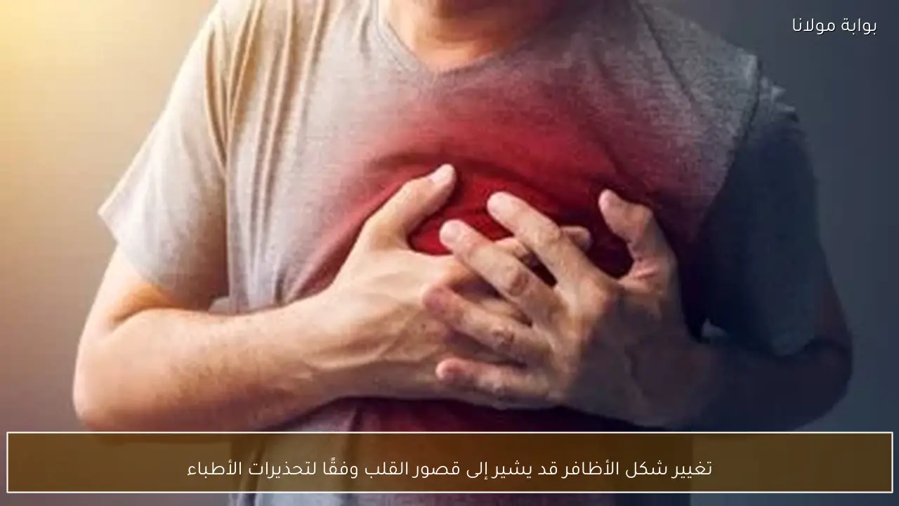 تغيير شكل الأظافر قد يشير إلى قصور القلب وفقًا لتحذيرات الأطباء