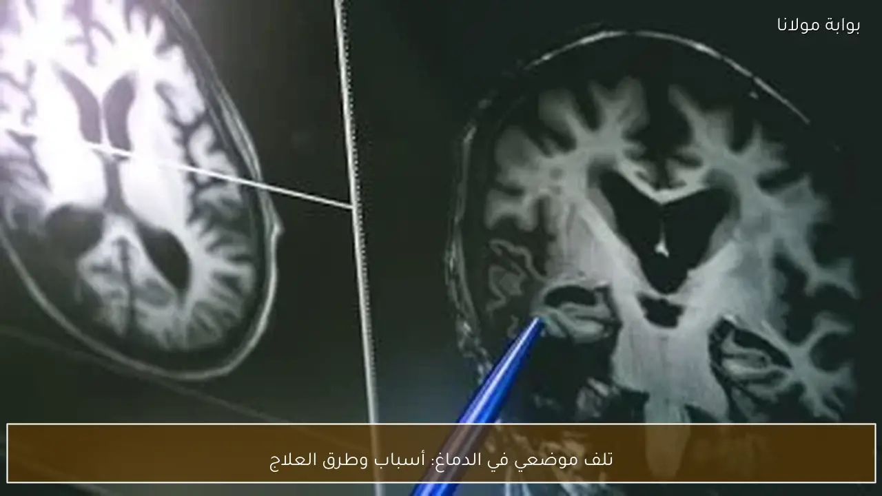 تلف موضعي في الدماغ: أسباب وطرق العلاج