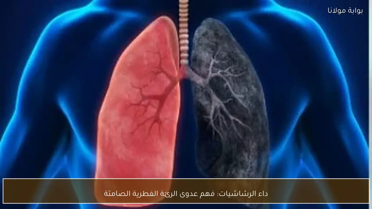 داء الرشاشيات: فهم عدوى الرئة الفطرية الصامتة