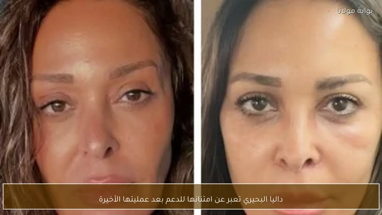 داليا البحيري تعبر عن امتنانها للدعم بعد عمليتها الأخيرة