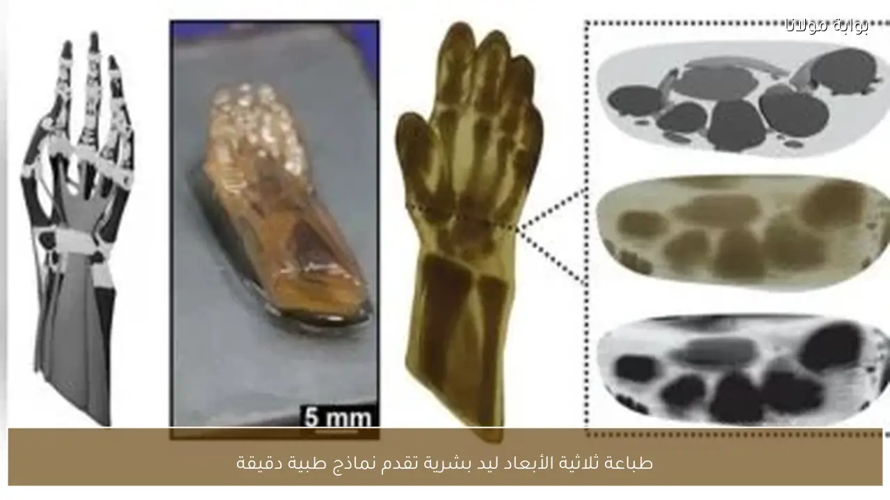 طباعة ثلاثية الأبعاد ليد بشرية تقدم نماذج طبية دقيقة