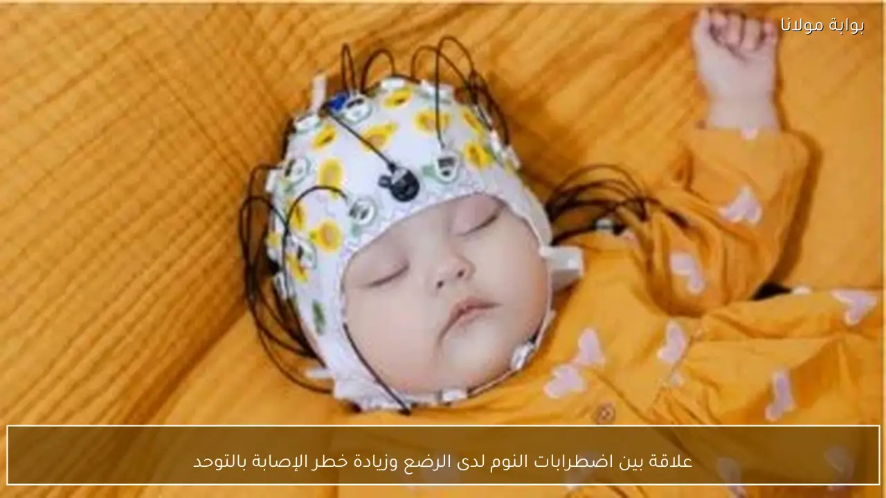 علاقة بين اضطرابات النوم لدى الرضع وزيادة خطر الإصابة بالتوحد