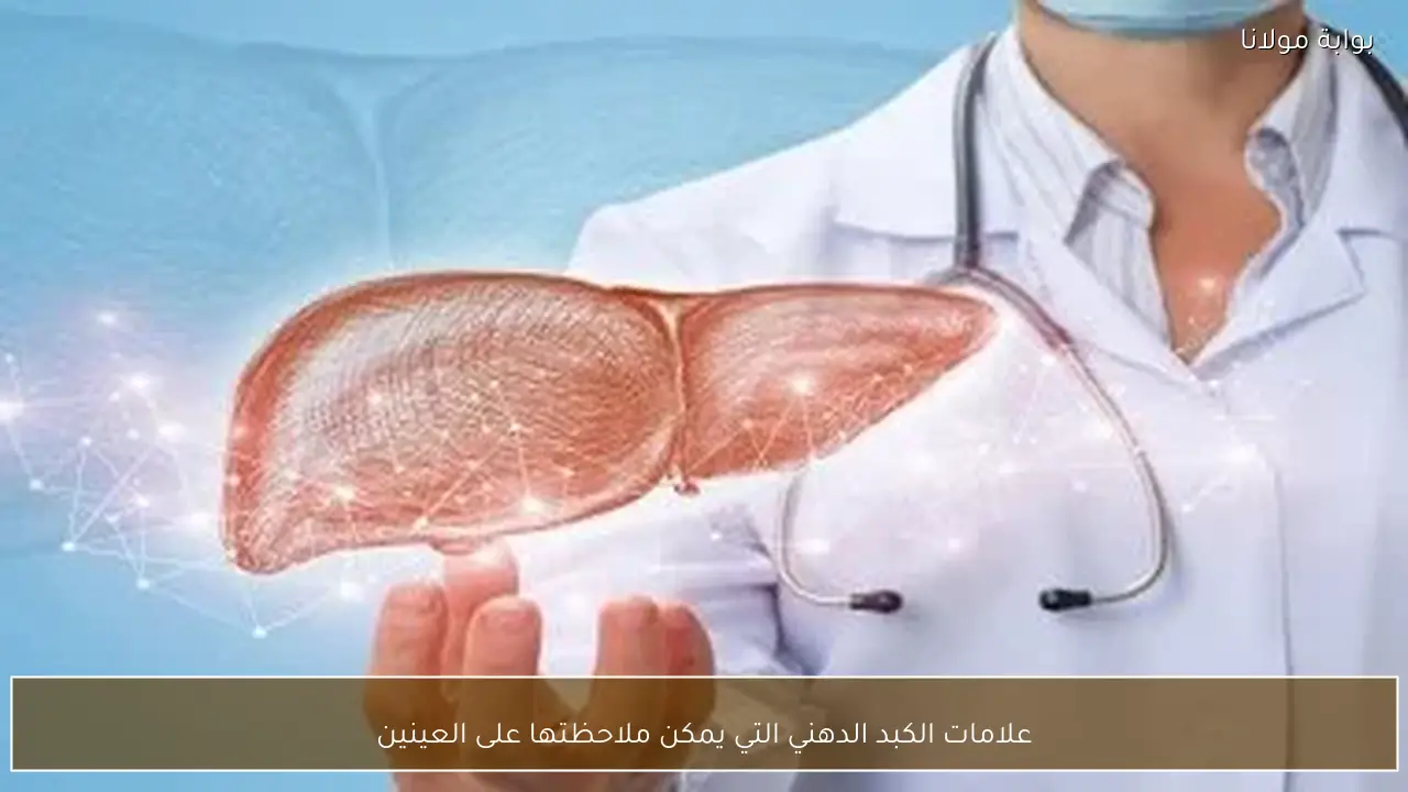 علامات الكبد الدهني التي يمكن ملاحظتها على العينين